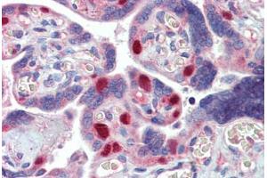 Placenta, Human: Formalin-Fixed, Paraffin-Embedded (FFPE) (MCL-1 抗体)