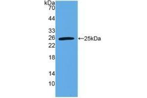 Detection of Recombinant VEGI, Human using Polyclonal Antibody to TNF Like Ligand 1A (TL1A) (TNF Like Ligand 1A (AA 67-251) 抗体)