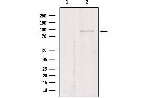 Western blot analysis of extracts from Mouse myeloma, using TMEM173/STING antibody. (STING/TMEM173 抗体  (Internal Region))