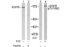 Image no. 1 for anti-Epidermal Growth Factor Receptor (EGFR) (pTyr1092) antibody (ABIN196760) (EGFR 抗体  (pTyr1092))