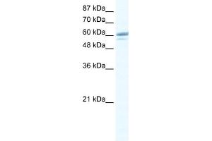 WB Suggested Anti-ZNF232 Antibody Titration:  0. (ZNF232 抗体  (Middle Region))