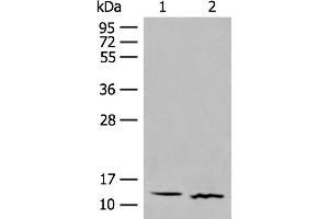 Western blot analysis of Human fetal brain tissue and Mouse thymus tissue lysates using GALP Polyclonal Antibody at dilution of 1:500 (GALP 抗体)