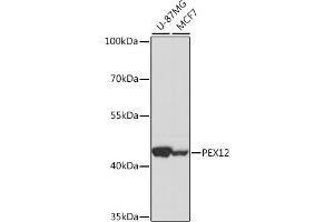 Western blot analysis of extracts of various cell lines, using PEX12 antibody (ABIN7269246) at 1:1000 dilution. (PEX12 抗体  (AA 290-359))