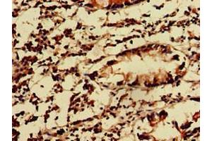 Immunohistochemistry of paraffin-embedded human appendix tissue using ABIN7157550 at dilution of 1:100 (KIDINS220 抗体  (AA 1077-1370))