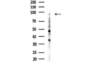 Western blot analysis of lysates from EC304 cells(heat-shock, 45 min treatment), using PK Antibody at 1/1000 dilution.