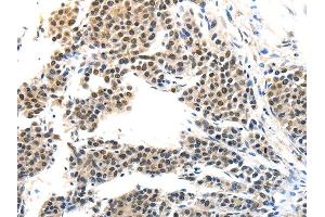 Immunohistochemistry (IHC) image for anti-Melanoma Antigen Family A, 6 (MAGEA6) antibody (ABIN5957147) (MAGEA6 抗体)