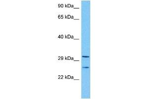 Host:  Mouse  Target Name:  TAL1  Sample Tissue:  Mouse Kidney  Antibody Dilution:  1ug/ml (TAL1 抗体  (Middle Region))