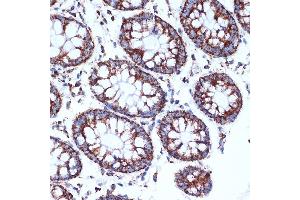 Immunohistochemistry (IHC) image for anti-ClpP Caseinolytic Peptidase, ATP-Dependent, Proteolytic Subunit Homolog (E. Coli) (CLPP) antibody (ABIN1682296)