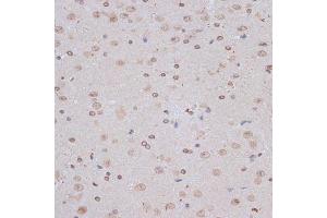 Immunohistochemistry (IHC) image for anti-Nuclear Factor (erythroid-Derived 2)-Like 1 (NFE2L1) (AA 515-772) antibody (ABIN7268969)