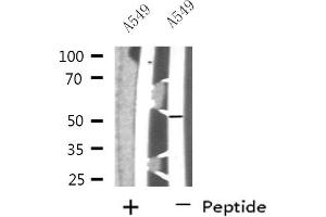 Western blot analysis of extracts from A549 cells, using NARFL antibody. (NARFL 抗体  (Internal Region))