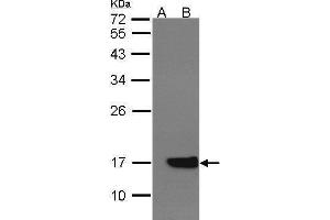 WB Image Western Blot analysis of CYB5A expression in transfected 293T cell line by CYB5A polyclonal antibody. (CYB5A 抗体)