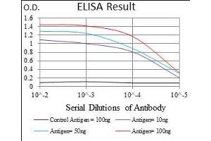 Black line: Control Antigen (100 ng), Purple line: Antigen(10 ng), Blue line: Antigen (50 ng), Red line: Antigen (100 ng), (Trefoil Factor 2 抗体  (AA 20-125))