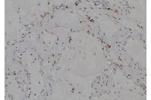 ABIN6277204 at 1/100 staining Human lung tissue by IHC-P. (Histone 3 抗体  (H3K79me))