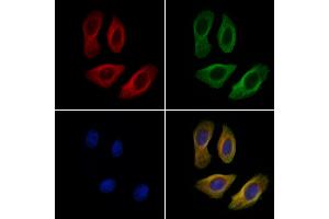 ABIN6263216 and ABIN6269229 staining Hela cells by IF/ICC.