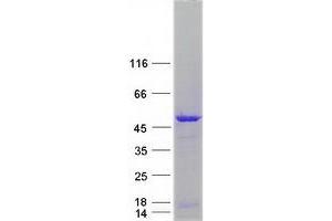 Validation with Western Blot
