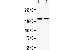 Western blot analysis of SAFB expression in HELA whole cell lysates ( Lane 1) and MCF-7 whole cell lysates ( Lane 2). (SAFB 抗体  (C-Term))