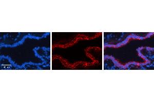 GCLC antibody - N-terminal region (ARP54576_P050) Catalog Number: ARP54576_P050  Formalin Fixed Paraffin Embedded Tissue: Human Bronchial Epithelial Tissue  Observed Staining: Cytoplasm and membrane of bronchial epithelial tissue Primary Antibody Concentration: 1:600  Secondary Antibody: Donkey anti-Rabbit-Cy3  Secondary Antibody Concentration: 1:200  Magnification: 20X  Exposure Time: 0. (GCLC 抗体  (N-Term))