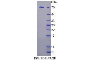 SDS-PAGE analysis of Mouse FKBPL Protein. (FKBPL 蛋白)