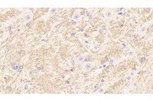 Immunohistochemistry (IHC) image for anti-Tubulin, beta 1 (TUBB1) (AA 182-437) antibody (ABIN7435847)