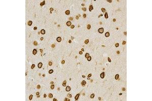 Immunohistochemistry of paraffin-embedded mouse brain using LMNA antibody at dilution of 1:200 (x400 lens). (Lamin A/C 抗体  (AA 403-572))