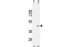 Western Blotting (WB) image for anti-Cochlin (COCH) antibody (ABIN2996145) (COCH 抗体)