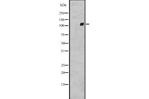 Western blot analysis of GPR64 expression in A431 whole cell lysate ,The lane on the left is treated with the antigen-specific peptide. (GPR64 抗体  (Internal Region))