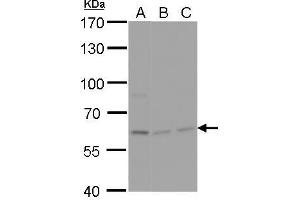 WB Image NPAS1 antibody detects NPAS1 protein by Western blot analysis. (NPAS1 抗体)