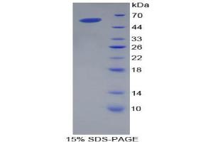 SDS-PAGE analysis of Pig Apolipoprotein A1 Protein. (APOA1 蛋白)