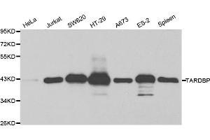 Western blot analysis of extracts of various cell lines, using TARDBP antibody (ABIN5970529) at 1/1000 dilution. (TARDBP 抗体)