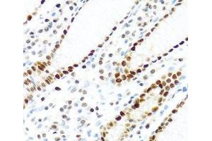 Immunohistochemistry of paraffin-embedded Human stomach using KHDRBS2 Polyclonal Antibody at dilution of 1:100 (40x lens). (KHDRBS2 抗体)