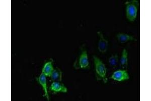 Immunofluorescence (IF) image for anti-Protein Phosphatase 2, Regulatory Subunit B, delta (PPP2R2D) (AA 1-192), (Regulatory Subunit B) antibody (ABIN7169250)