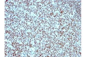 Formalin-fixed, paraffin-embedded human Tonsil stained with Nucleolin Monoclonal Antibody (SPM614). (Nucleolin 抗体)
