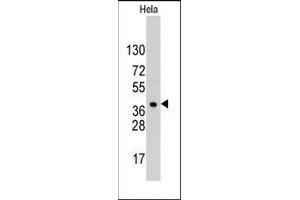 Western blot analysis of anti-HDGF Pab in Hela cell line lysates (35ug/lane). (HDGF 抗体  (C-Term))