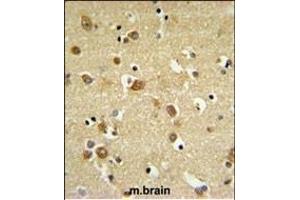 GABRD Antibody (Center) (ABIN653247 and ABIN2842772) IHC analysis in formalin fixed and paraffin embedded brain tissue followed by peroxidase conjugation of the secondary antibody and DAB staining. (GABRD 抗体  (AA 331-358))