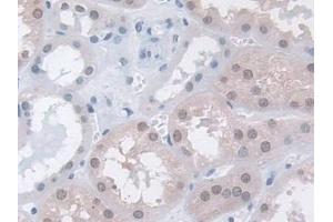 DAB staining on IHC-P; Samples: Human Kidney Tissue