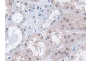 DAB staining on IHC-P; Samples: Human Kidney Tissue (MPP5 抗体  (AA 455-675))
