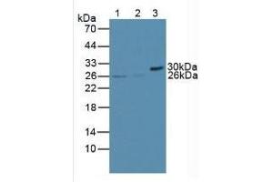 Western Blotting (WB) image for B-Cell CLL/lymphoma 2 (BCL2) ELISA Kit (ABIN6574202)