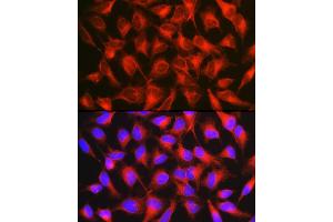 Immunofluorescence analysis of HeLa cells using [KO Validated] CD171/L1CAM Rabbit pAb (ABIN6131538, ABIN6143053, ABIN6143054 and ABIN7101826) at dilution of 1:150 (40x lens). (L1CAM 抗体  (AA 1143-1257))