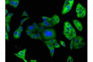 Immunofluorescence staining of HepG2 cells with ABIN7164832 at 1:166, counter-stained with DAPI. (PCSK9 抗体  (AA 153-380))
