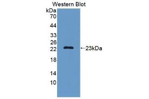 Detection of Recombinant SF3B3, Mouse using Polyclonal Antibody to Splicing Factor 3B Subunit 3 (SF3B3) (SF3B3 抗体  (AA 35-210))