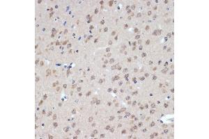 Immunohistochemistry of paraffin-embedded mouse brain using XPD/ERCC2 Rabbit mAb (ABIN7267057) at dilution of 1:100 (40x lens). (ERCC2 抗体)
