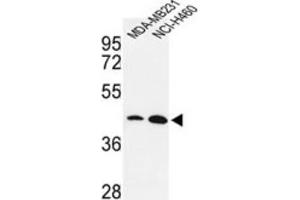 Western Blotting (WB) image for anti-Kruppel-Like Factor 4 (Gut) (KLF4) antibody (ABIN3001588) (KLF4 抗体)
