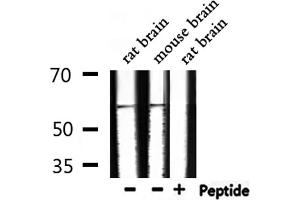 Western Blotting (WB) image for anti-Proto-oncogene tyrosine-protein kinase Src (Src) (pTyr530) antibody (ABIN6256758)