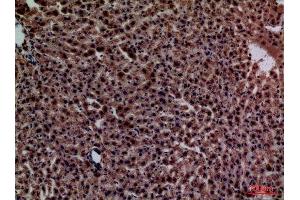 Immunohistochemistry (IHC) image for anti-C-Reactive Protein (CRP) (Internal Region) antibody (ABIN3187732)