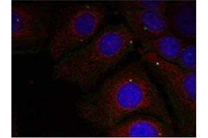 Image no. 1 for anti-Synuclein, alpha (SNCA) (pTyr125) antibody (ABIN401546) (SNCA 抗体  (pTyr125))