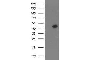 Western Blotting (WB) image for anti-SET Domain Containing (Lysine Methyltransferase) 7 (SETD7) antibody (ABIN1500903)