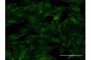 Immunofluorescence of monoclonal antibody to CD9 on HeLa cell. (CD9 抗体  (AA 112-195))