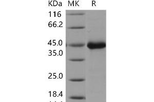 Western Blotting (WB) image for WNT Inhibitory Factor 1 (WIF1) protein (His tag) (ABIN7320086) (WIF1 Protein (His tag))
