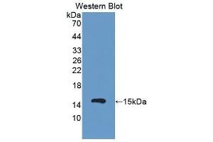 Western Blotting (WB) image for anti-Complement Factor B (CFB) (AA 474-590) antibody (ABIN1858373) (Complement Factor B 抗体  (AA 474-590))