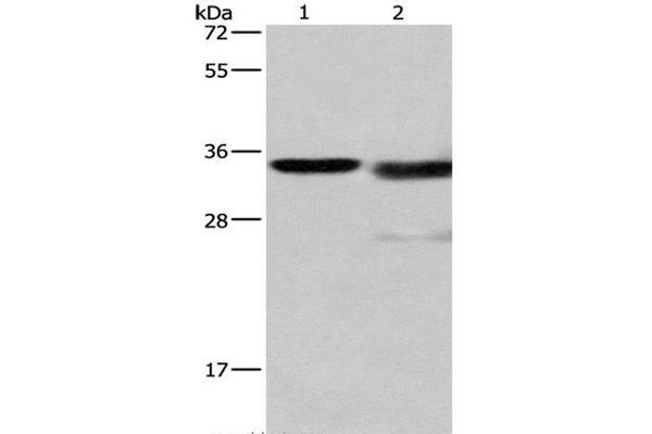 Cathepsin L 抗体